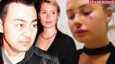 Chloe Loughnan dayak mı yedi?